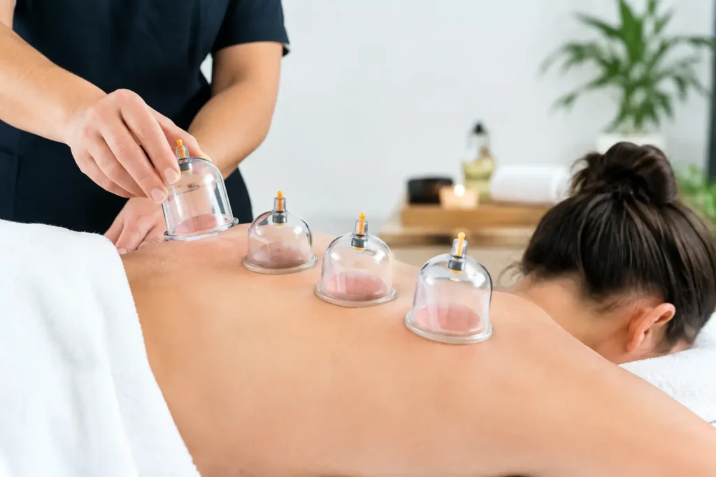 A Practical Guide to Therapeutic Cupping Support